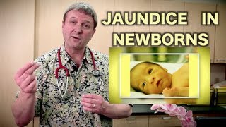 Jaundice in Newborns Pediatric Advice [upl. by Eanej839]