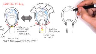 Obstetrics  Stage I of Labour [upl. by Atnuahsal137]