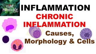 INFLAMMATION 8 CHRONIC INFLAMMATION Causes Morphology amp Cells [upl. by Rhoda]