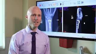 Broken Wrists Fracture Types Treatment Options amp Recovery  Dr Froelich [upl. by Ztirf591]