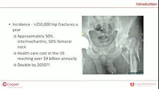 IM nail vs SHS for intertrochanteric femur fractures  debate [upl. by Renick542]