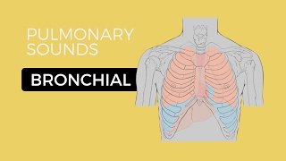 Bronchial Breath Sounds  Lung Sounds  Medzcool [upl. by Kehr942]