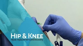 Anaesthesia  ACL Surgery [upl. by Nileuqcaj893]