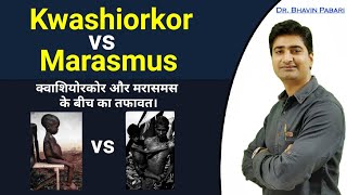 KWASHIORKOR VS MARASMUS difference  Malnutrition disease in child  Full detail in hindi [upl. by Iverson]