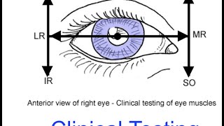 Neuro  Cranial Nerve 3 Palsy [upl. by Colwen275]