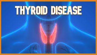 Hyperthyroidism vs Hypothyroid RN LPN NCLEX [upl. by Euqirdor]