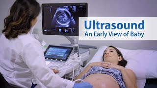 Fetal Echocardiography Tetralogy of Fallot [upl. by Malkin]