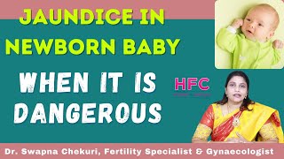 Jaundice In New Born Babies  Symptoms amp Treatment  Dr Swapna Chekuri  HFC [upl. by Atokad]