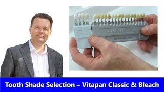 Tooth Shade Selection with your dentist Vitapan Classic  Bleach [upl. by Irual]