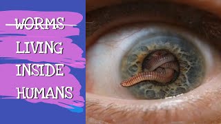 WORMS LIVING INSIDE HUMANS  EXPLAINED [upl. by Garey]