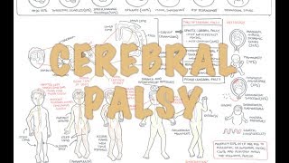 Cerebral Palsy  DETAILED Overview [upl. by Jordan]