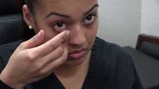 How to Apply Ointment to the Eyes and Eyelids [upl. by Paddie]