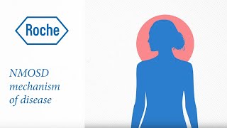 Neuromyelitis optica spectrum disorder  Mechanism of disease [upl. by Amolap]