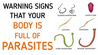 Dont Ignore These Early Symptoms Of Parasites In Your Body [upl. by Halyahs]