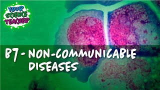 B7  WHOLE TOPIC GCSE NONCOMMUNICABLE DISEASE [upl. by Aretak]