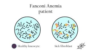 Fanconi Anemia  Genetic diagnosis [upl. by Nnel675]