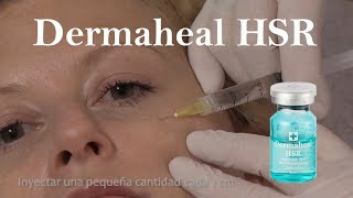 Dermaheal HSR producto de mesoterapia para rejuvenecimiento estrías y cicatrices de acné [upl. by Nirik250]