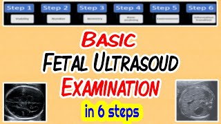 Fetal Echocardiography Explained  Dr Mahua Roy Bengali [upl. by Eiznekcam]