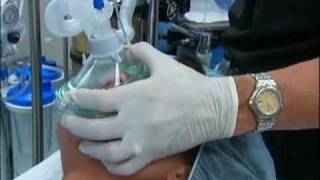 NT About Anesthesia Ch 5  General Anesthesia [upl. by Adim777]