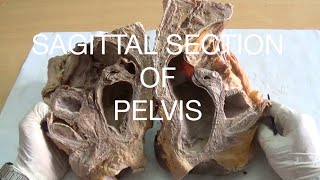 SAGITTAL SECTION OF PELVIS  DEMONSTRATION  ANATOMY [upl. by Card]