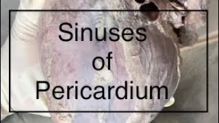 Sinuses of Pericardium Anatomy [upl. by Florence179]