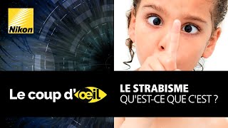 Opération des yeux  Hypermétropie Astigmatisme et Strabisme [upl. by Milena68]