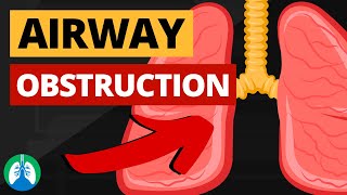 Airway Obstruction Medical Definition  Quick Explainer Video [upl. by Japeth]