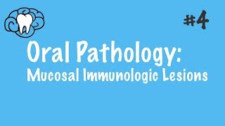 Oral Pathology  Mucosal Immunologic Diseases  INBDE ADAT [upl. by Maxa232]