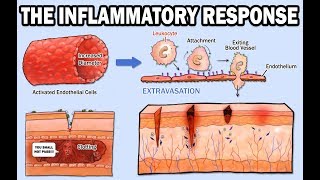 THE INFLAMMATORY RESPONSE [upl. by Ardnasirhc]