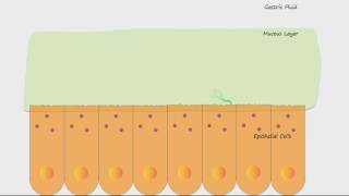 H Pylori and Ulcers [upl. by Ivon]