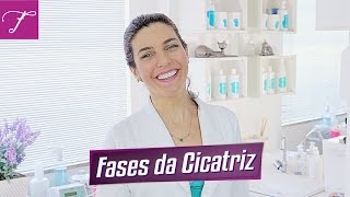 Sua cicatriz está em qual fase [upl. by Sarene]