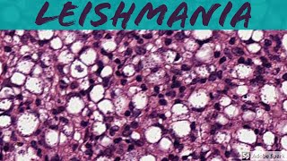 Leishmaniasis 5Minute Pathology Pearls [upl. by Iona]