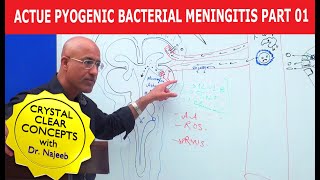 Acute Pyogenic Bacterial Meningitis Part 1 🩺 [upl. by Luisa]