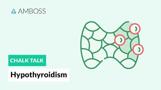 Hypothyroidism A Diagnostic Approach [upl. by Pittel]