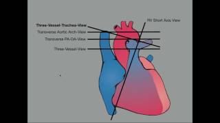 The Physiology of Electronic Fetal Monitoring EFM [upl. by Meakem]