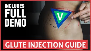 All You Need To Know About Joint Injections [upl. by Vincelette]