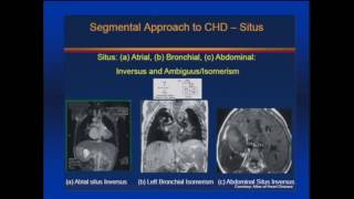 Fetal Echocardiography [upl. by Huntington]