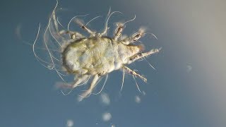 Dust Mite Under the Microscope [upl. by Ilenna]