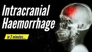 Intracranial Haemorrhage Types signs and symptoms [upl. by Finer]