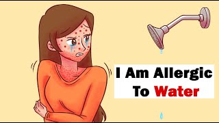 Allergies  Causes Symptoms and Treatment Options [upl. by Willem241]