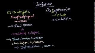 Neisseria meningitidis infection [upl. by Truc]