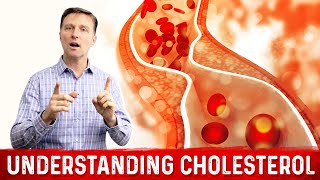 How to Read and Understand Your Cholesterol Levels [upl. by Gosser]