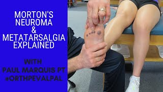 Mortons Neuroma and Metatarsalgia Whats the Difference [upl. by Ttayw]