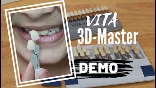 VITA 3DMaster shade guide  How to use [upl. by Atwater]