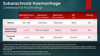 Subdural Hematoma Causes and Symptoms [upl. by Drice540]