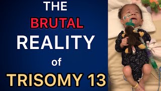 The BRUTAL Reality of Having a Trisomy Child Trisomy 13 amp 18 13トリソミー [upl. by Pasadis]