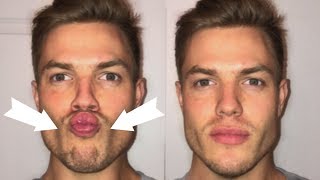 3 Exercises To Lose CHUBBY Cheeks Get a Defined Face [upl. by Anagrom]