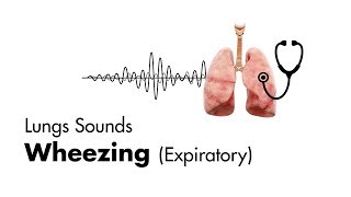 What bronchitis sounds like [upl. by Ysiad]