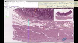 Histology Helper  Digestive System II Histology [upl. by Karolina]