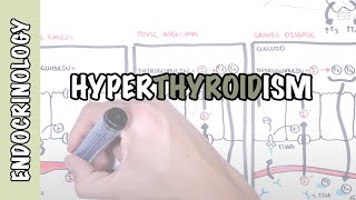 Hyperthyroid vs Hypothyroid [upl. by Amelita547]